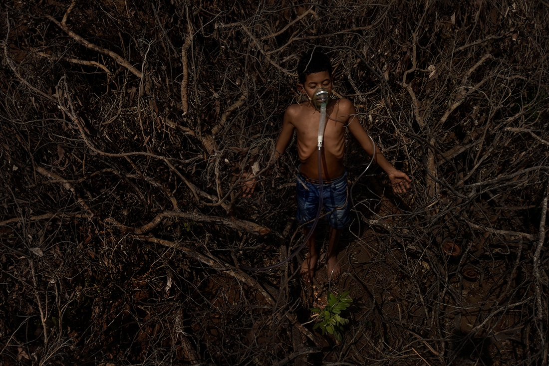 Anthropogenic